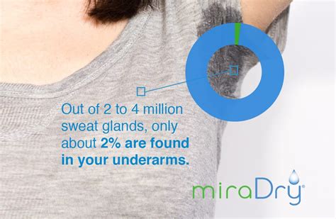 Miradry® Treatment To Stop Excessive Sweating Define Medical Clinic