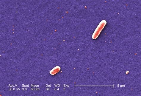 Free Picture Gram Negative Escherichia Coli Bacteria 91000 Hot Sex Picture