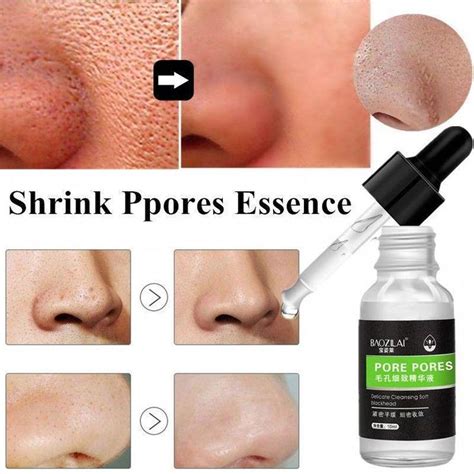 Help To Shrink Pores Gentle Conditioning The Skin And Repair Pores So