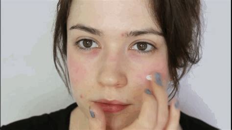 5 Easy Steps To Covering Up Redness With Makeup Rosacea Skin Care Rosacea Skin Treatment