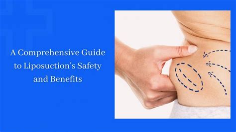 A Comprehensive Guide To Liposuction S Safety And Benefits