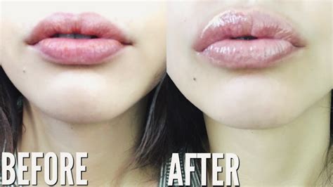 How To Get Bigger Lips Naturally Without Makeup Youtube