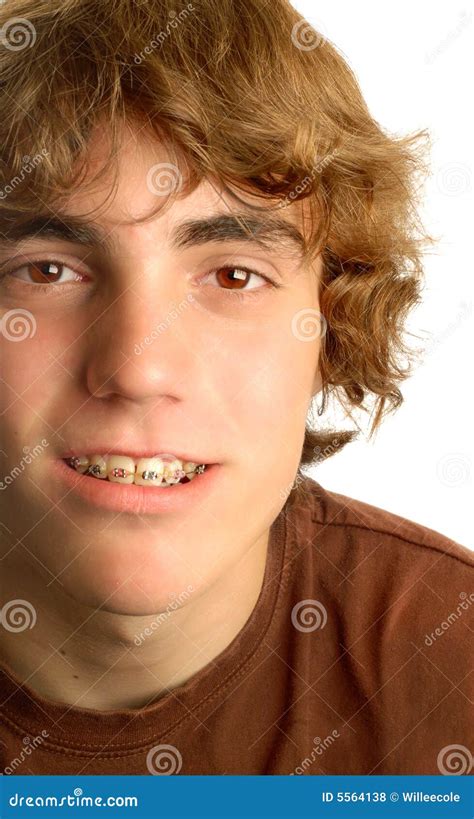 Teen Boy Wearing Braces Stock Photo Image Of Orthodontic 5564138