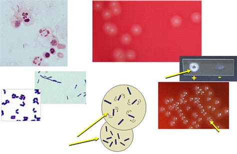 Gram stain of listeria monocytogenes (source). Listeria