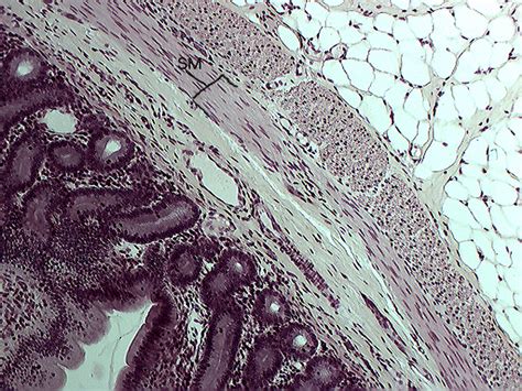 The probably origin of these smooth muscle include ovarian hilar blood vessels, but other possible origins are cells in the ovarian ligament, smooth muscle cells or multipotential cells in the 11,12 on histology, ols must be distinguished from cellular fibromas and stromal sclerosing tumors of the ovary. Smooth muscle small intestine 10x | Histology