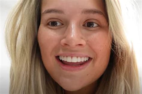 Molly Mae Hague Reveals Teeth Transformation