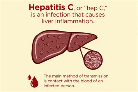Hepatitis C Symptoms Equip Health