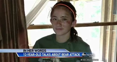 Young Girl Attacked By Bear Shares Story Videos Metatube
