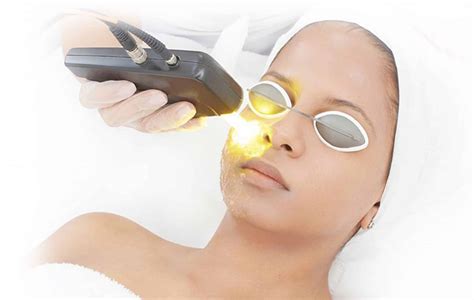 Yellow Laser Skin Treatment Beauty Plus Clinic