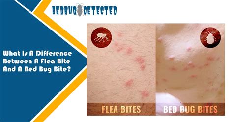 Bed Bugs Vs Fleas Difference Between A Flea Bite And A Bed Bug Bite