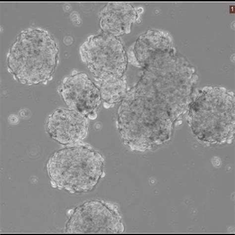 1 Sphere Formation Assay Aldh1 Cells Formed Spheres And The