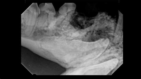 A Dentigerous Cyst In A Boston Terrier Dog Youtube