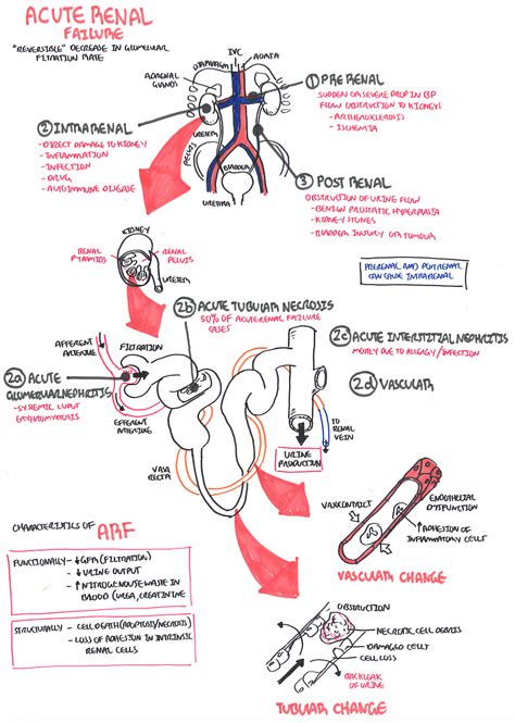 Kidney failure occurs when the kidneys lose. Acute Kidney Injury Prerenal Intrarenal Postrenal - Kidney ...