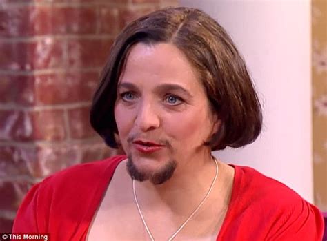 Excessive hair growth (hirsutism) hirsutism is where women have thick, dark hair on their face, neck, chest, tummy, lower back, buttocks or thighs. 10 Examples of Female Facial Hair | Page 2 of 10 | The ...