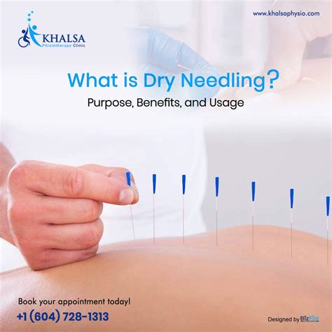 what is dry needling purpose benefits and usage