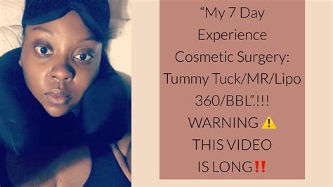 My 7 Day Experience With Cosmetic Surgery Tummy Tuckmrlipo 360bbl