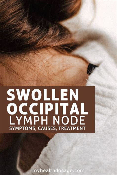 Swollen Occipital Lymph Nodes Bastashark