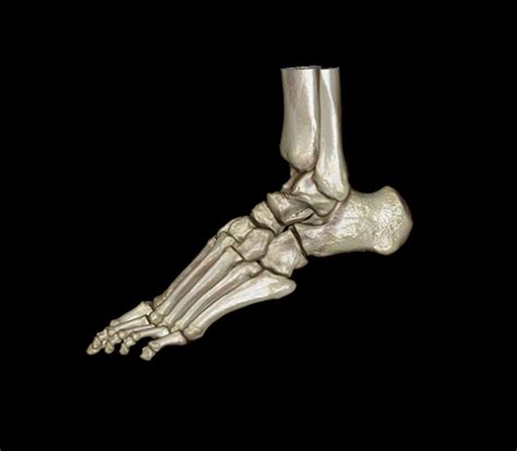 Normal Foot 3d Ct Scan Photograph By Zephyr