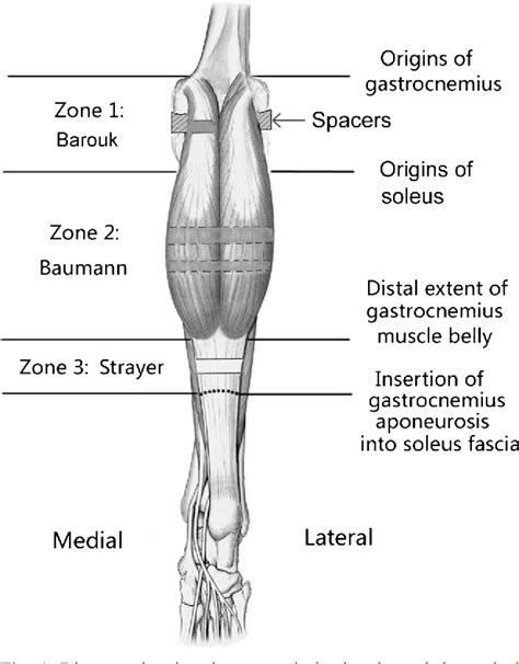 Comparison Of The Efficacy Of Three Isolated Gastrocnemius Recession