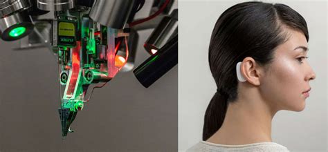 Neuralink V2: il chip cerebrale di Elon Musk si aggiorna