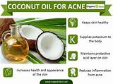 Photos of How To Use Coconut Oil For Acne Scars