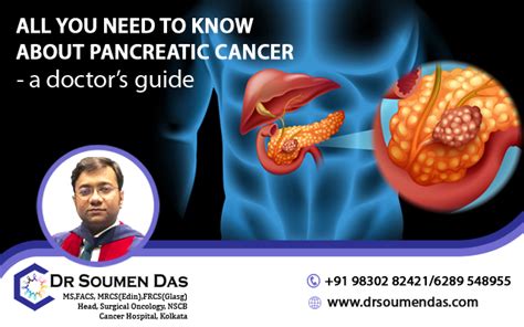 All You Need To Know About Pancreatic Cancer A Doctors Guide
