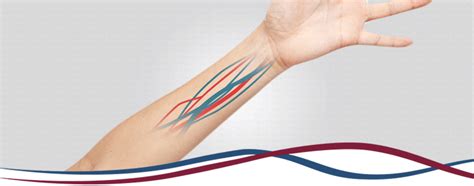 Meaning of fistula medical term. Fístula para Hemodiálise - Dr. Rodrigo Bono Fukushima