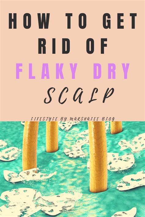 How To Get Rid Of Flaky Dry Scalp Dry Scalp Remedy Dry Flaky Scalp