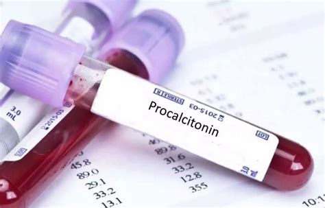 Procalcitonin Guided Care Can Minimize Antibiotic Use In Patients With