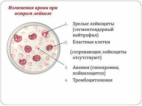 Диета при остром миелобластном лейкозе Лейкозы - презентация онлайн Лейкозы - презентация онлайн Диета при остром миелобластном лейкозе