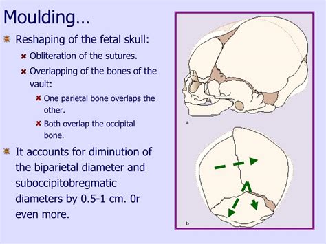 Ppt Obstetric Anatomy Powerpoint Presentation Free Download Id3778290