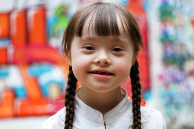 Children with down's syndrome have multiple malformations, medical conditions and cognitive impairment because of the presence of extra genetic material. Krankenkassen sollen Test auf Down-Syndrom bezahlen