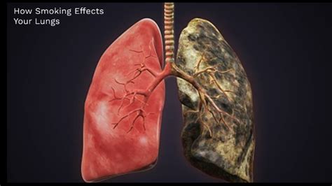 How Smoking Effects Your Lungs By Felicity Hajjar On Prezi