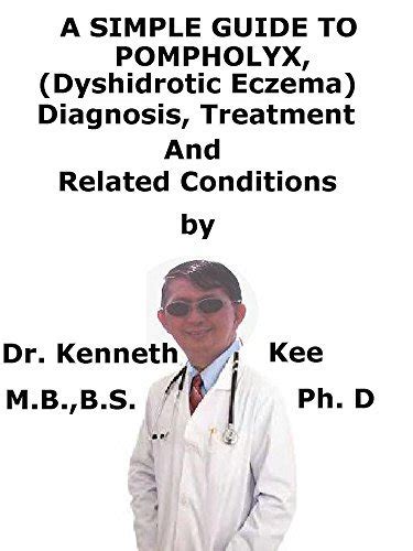 A Simple Guide To Pompholyx Dyshidrotic Ezcema Diagnosis Treatment