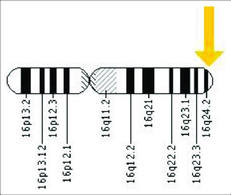 Mc1r Gene Location On Chromosome 16p243 Retrieved From Download Scientific Diagram