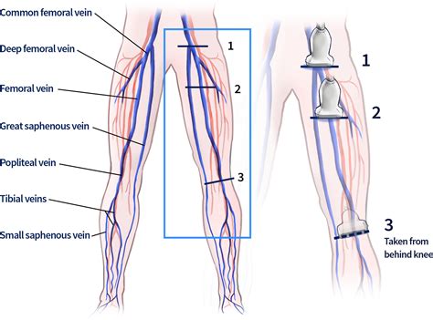 Superficial Femoral Vein