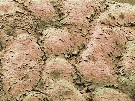 Skin Surface Sem Stock Image C0011783 Science Photo Library