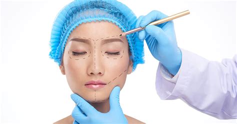 Cosmetic medical procedures, such as to reduce wrinkles, are usually not covered by health insurance. Best Doctor for Cosmetic & Plastic Surgery in India ...