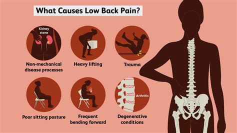 Best Exercises For Low Back Pain Relief Fitpage Expert Advice