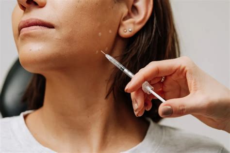 Discover The Most Common Areas For Cosmetic Botox Curated Medical