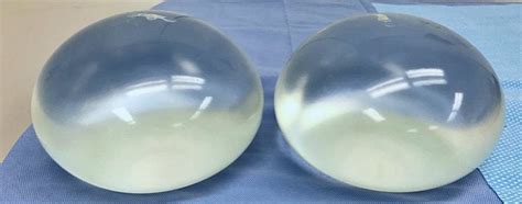 My Old Set Of 3000cc Breast Implants Absoluteunits