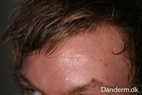 7>special for professional hair styling, suit for all kinds of hair. 4-124-7 Pomade acne from hair gel