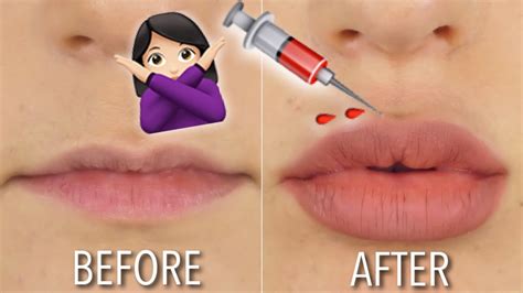 Diy Lip Plumper At Home How To Make A Diy Lip Plumper Using Stuff You