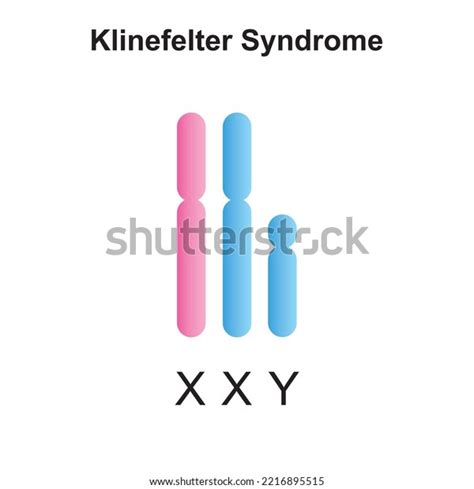 Scientific Designing Klinefelter Syndrome Xxy Colorful Stock Vector