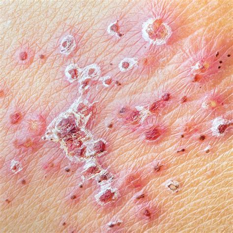 Allergens, heat, and certain medical conditions (some more serious than others) can all cause skin. Viral Skin Conditions: Pictures of Rashes, Blisters, and ...