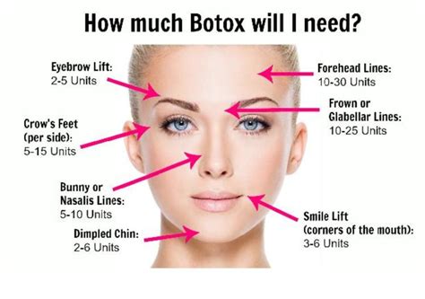How Much Botox Will I Need Acqua Blu Medical Spa