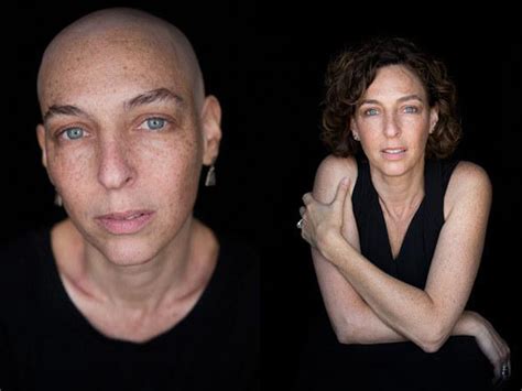 Inspiring Photo Shoot Captures Women Before And After Chemotherapy