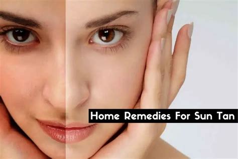 39 Natural Home Remedies To Remove Sun Tan Wellnessguide