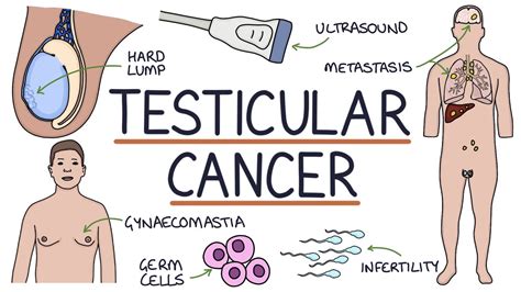 Understanding Testicular Cancer YouTube