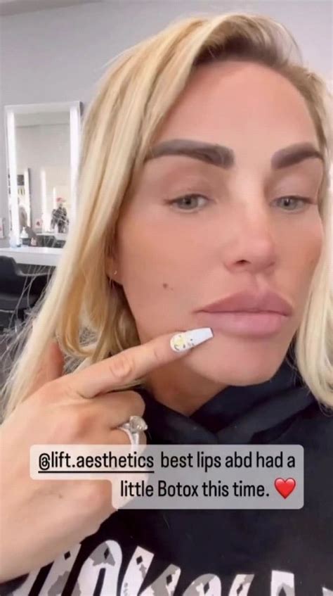 Katie Prices Latest Cosmetic Enhancement As She Get Lips Done For